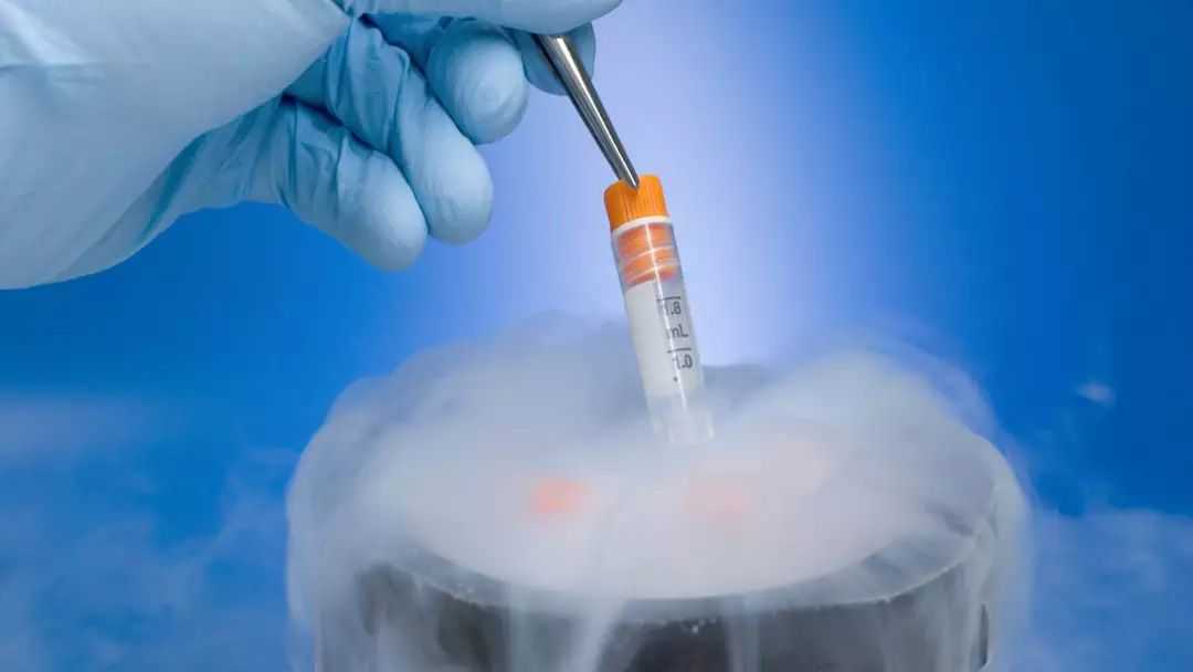 孕期血常规检查：重要性及必要性解析