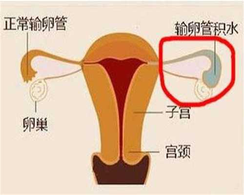 香港代孕条件：炖猪脚时，第一步绝对不要焯水