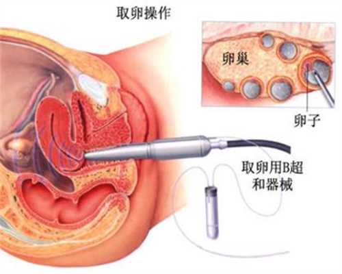香港代孕包生m：特殊人群用药--孕妇、哺乳期妇