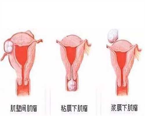 怀孕四个月胎儿发育与母体变化