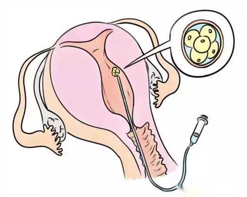 代孕可以按摩足部吗 需注意力度手法