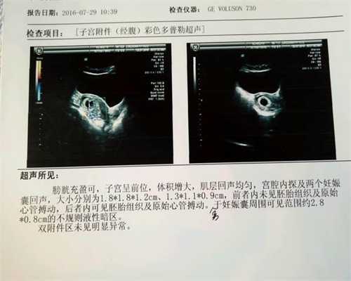 北京好的不孕不育医院：钟丽缇代孕第四胎, 回应