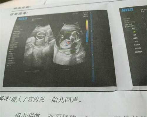 北京好的不孕不育医院：钟丽缇代孕第四胎, 回应