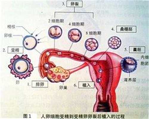 宫颈免疫性不孕：适合多囊卵巢 补肾活血促卵的