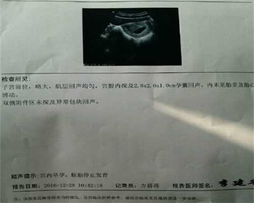 国外代孕哪里放心:早期输卵管堵塞的症状