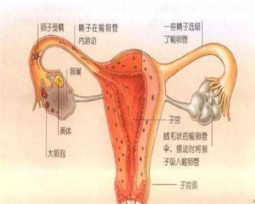 代孕可靠吗:造成输卵管堵塞的原因有哪些