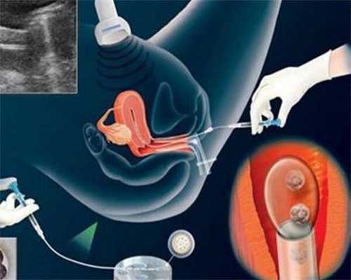 40多岁代孕:女性卵巢囊肿的原因有什么