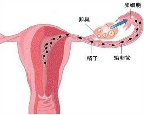 代孕哪里技术好:女性输卵管堵塞的症状你知道吗