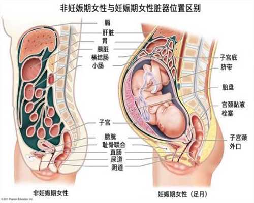 上海借卵生子:夫妻不孕男女都有份 如何预防不孕