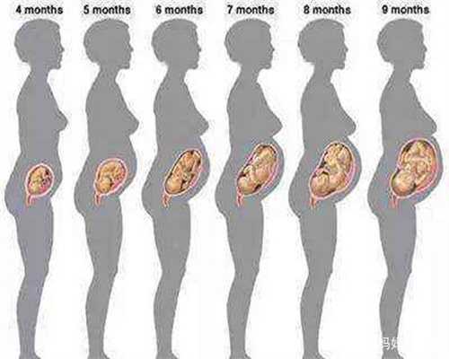 大同代孕流程,卵巢囊肿对怀孕有什么影响？？