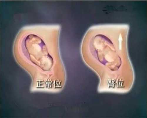 广州包成功代孕网-广州代孕网收费-代孕产子多少