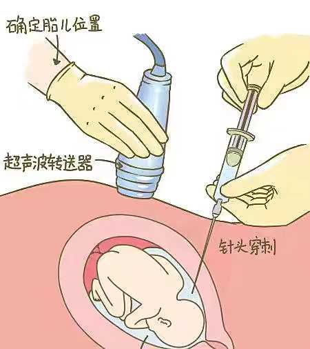 南京助孕还是自然备孕？利弊对比分析