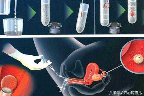 南京促排卵方案对比：哪个更适合你？