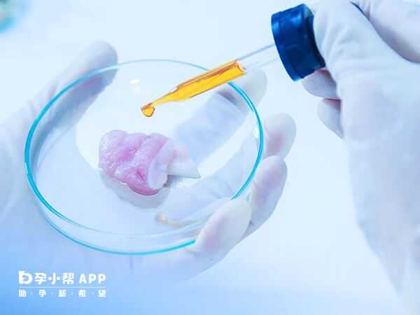 高龄备孕必做五项检查，你漏了吗？
